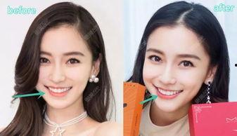 明星网红整形审美分析,明星审美趋势下的美丽蜕变之路