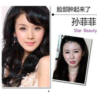 明星网红整形审美分析,明星审美趋势下的美丽蜕变之路