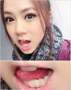 明星网红牙齿矫正图片高清,高清图片揭秘美丽蜕变之路