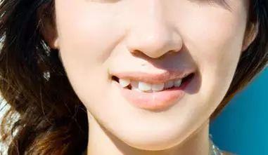 明星网红牙齿矫正图片高清,高清图片揭秘美丽蜕变之路